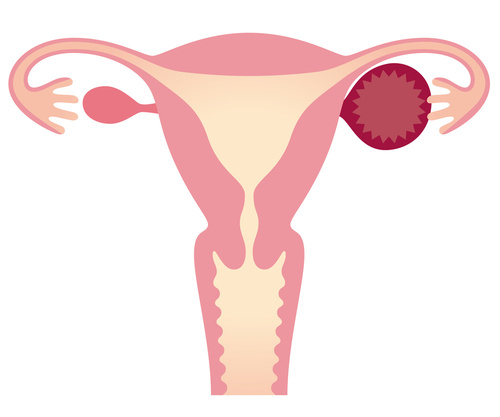画像：子宮がん検診